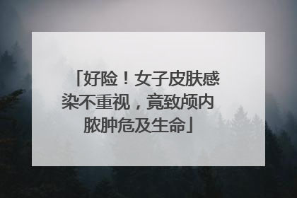 好险！女子皮肤感染不重视，竟致颅内脓肿危及生命